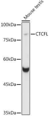 Western Blot: BORIS Antibody [NBP2-92659] - Western blot analysis of extracts of various cell lines, using BORIS antibody (NBP2-92659) at 1:1000 dilution. Secondary antibody: HRP Goat Anti-Rabbit IgG (H+L) at 1:10000 dilution. Lysates/proteins: 25ug per lane. Blocking buffer: 3% nonfat dry milk in TBST. Detection: ECL Basic Kit. Exposure time: 8s.